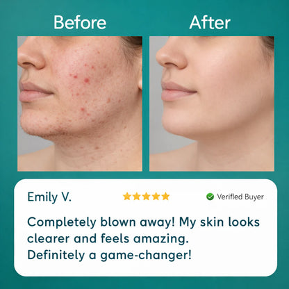 Gloomly™ Hormonal Hair Remover